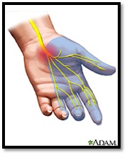 Hand Diagram